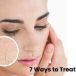 7 Ways to Treat Dry Skin