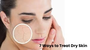 7 Ways to Treat Dry Skin