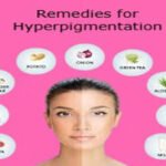 Effective Natural Remedies for Hyperpigmentation.