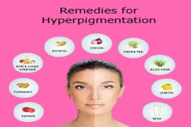 Effective Natural Remedies for Hyperpigmentation.