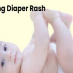 Tips for Treating Diaper Rash.