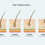 What are the steps involved in hair restoration?
