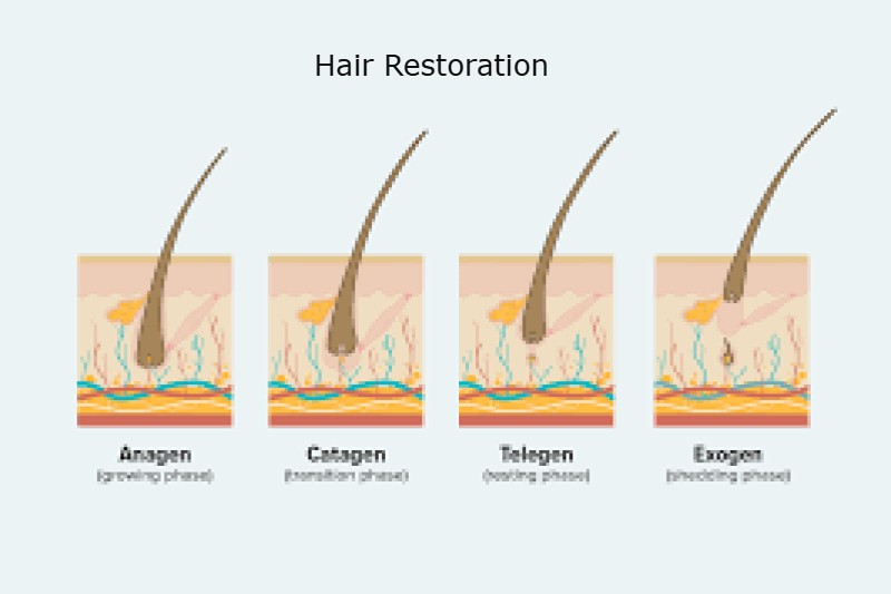 What are the steps involved in hair restoration?
