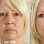 Reduce facial age by 10 years