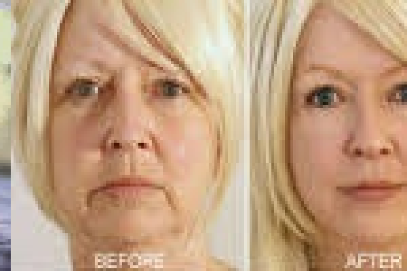 Reduce facial age by 10 years