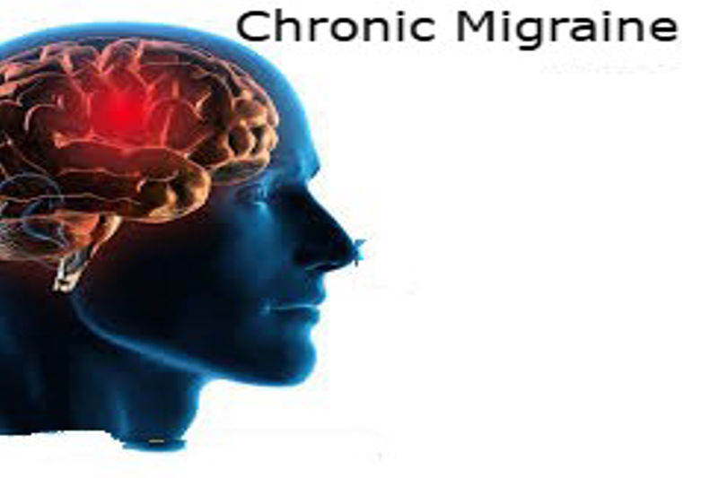 Managing Chronic Migraine: Current and Emerging Treatments.